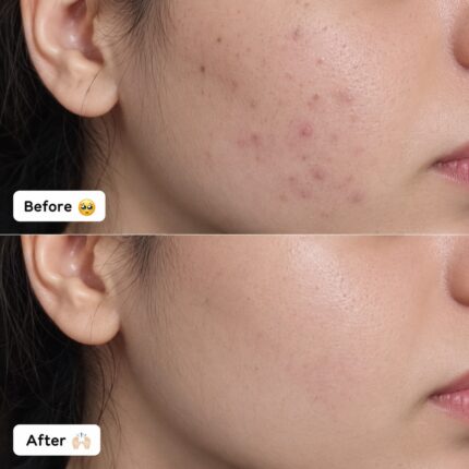 before after results