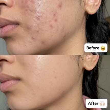 before after results